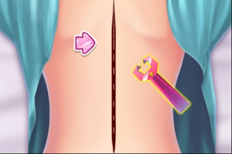 Anna Scoliosis Surgery